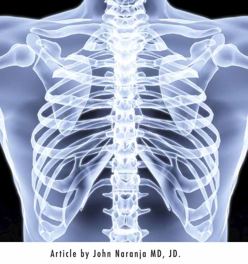 chest x-ray