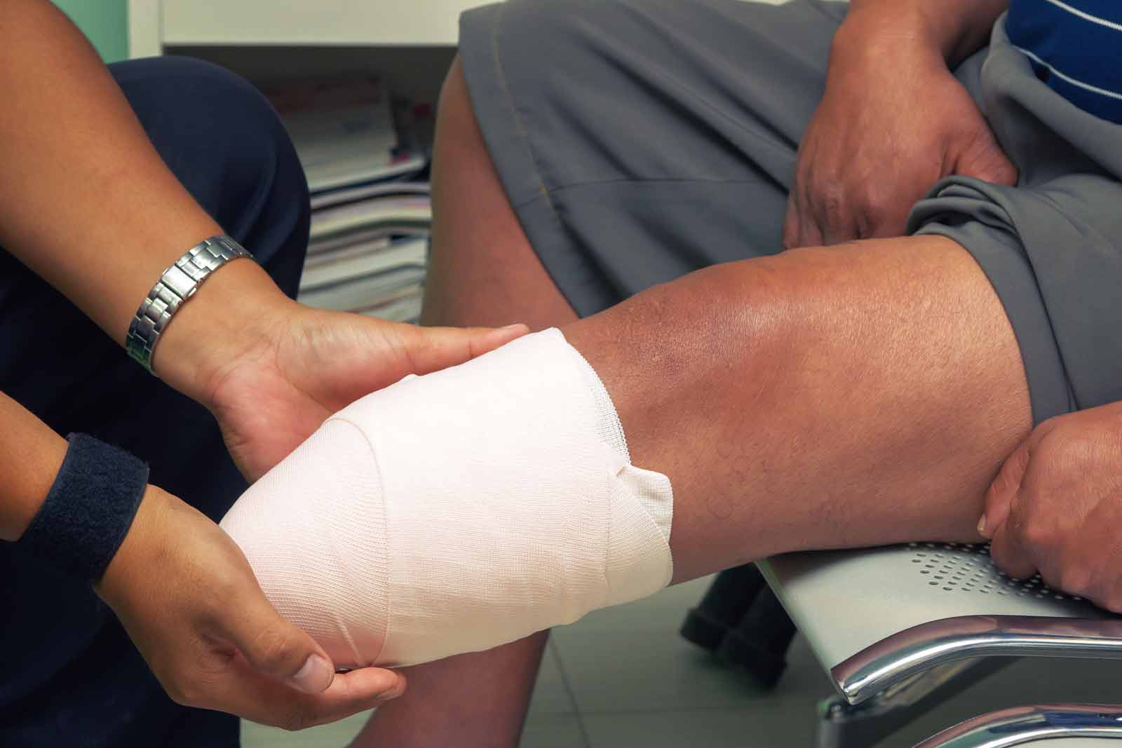 doctor teaches the patient to take care limb after amputation by bandaging on stump.