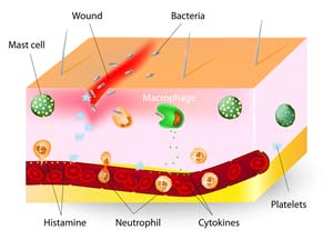 factors within the wound that affect healing