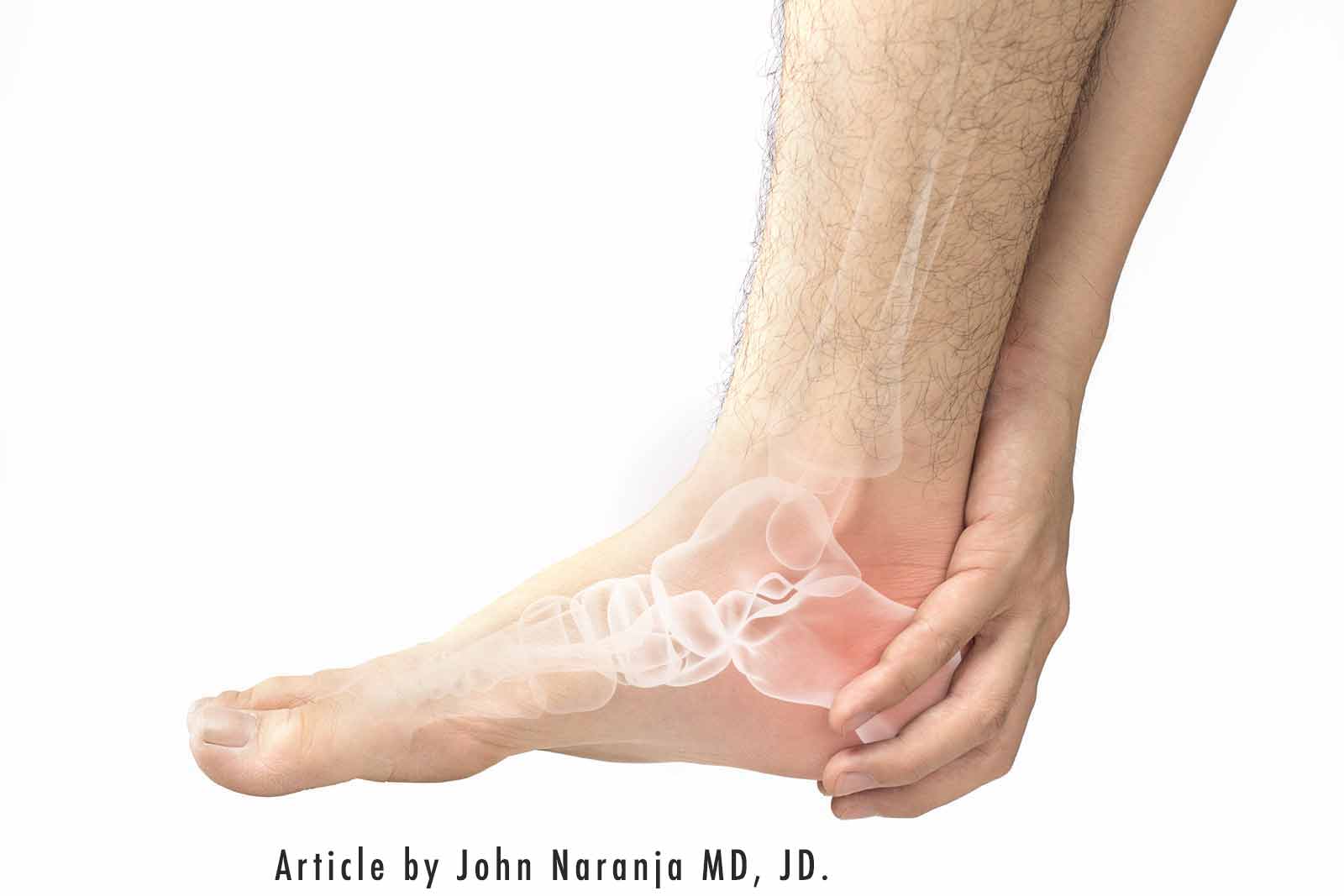 foot with pain and numbness in bones - article by dr. john naranja, md, jd