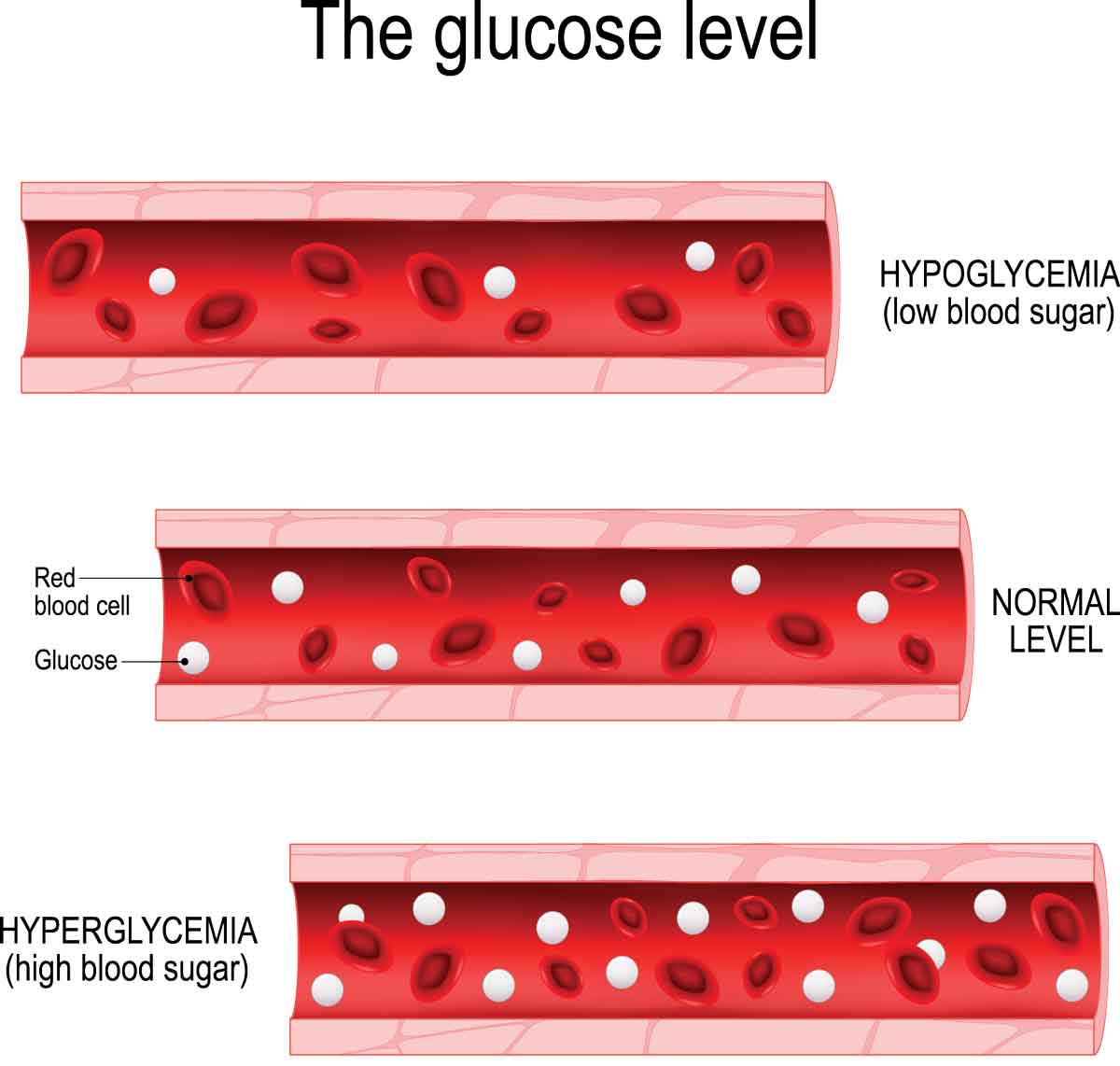 glucose in blood stream - illustration of gluscose levels