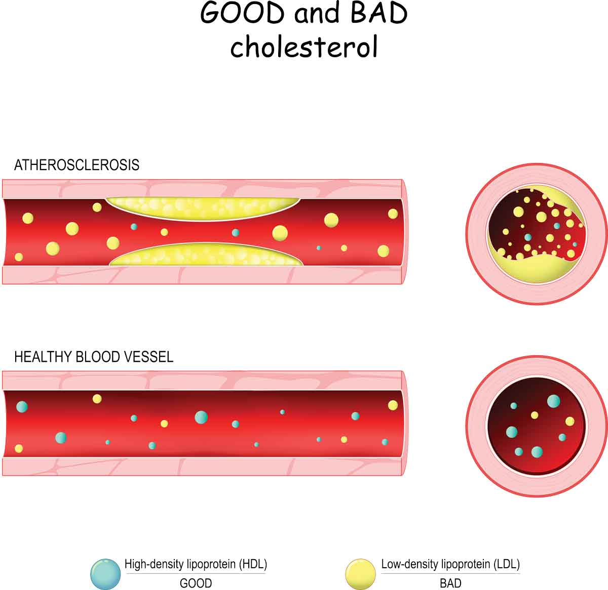 good (HDL) and bad (LDL) cholesterol
