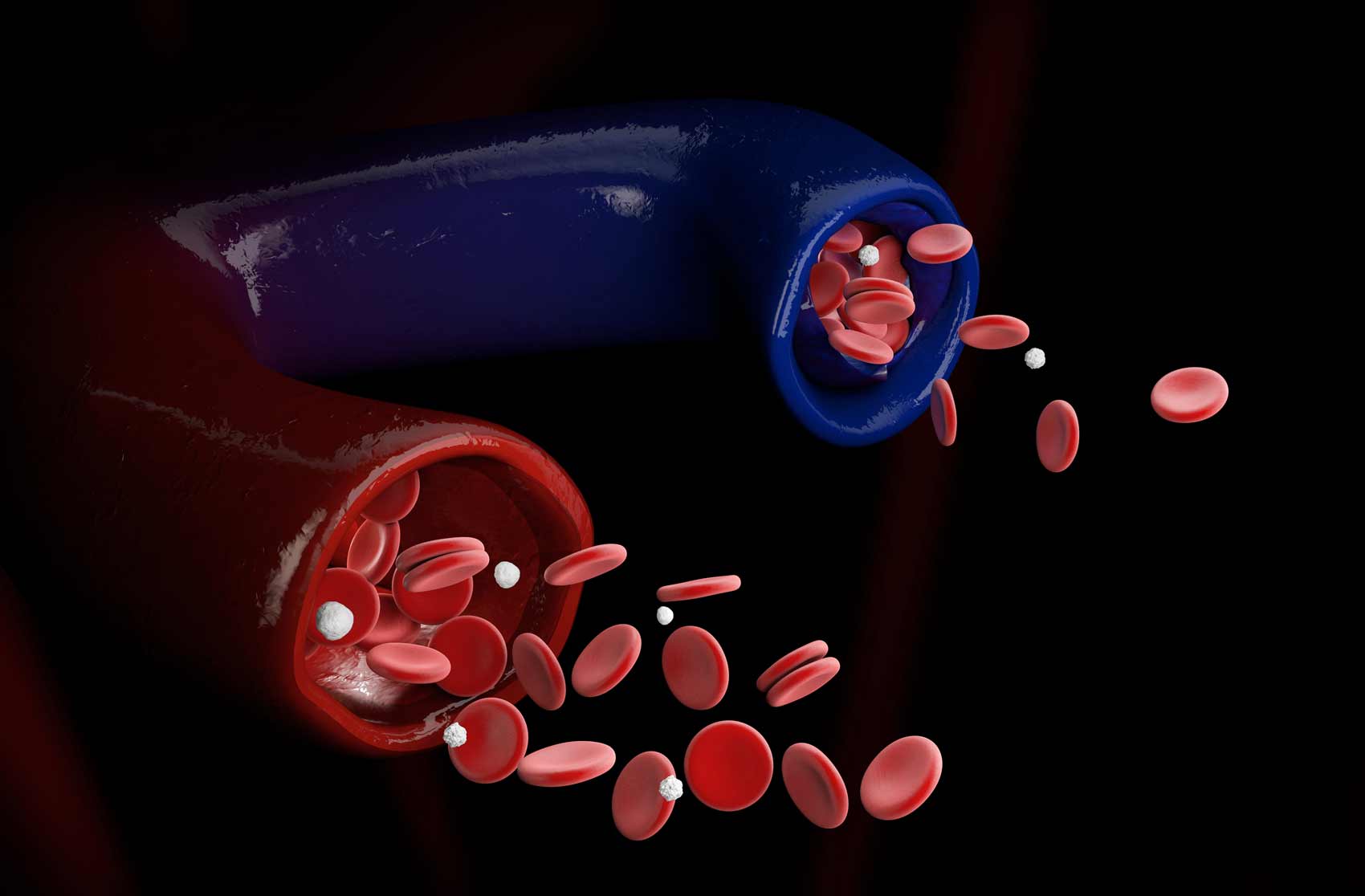 3D illustration of varicose vein and normal vein