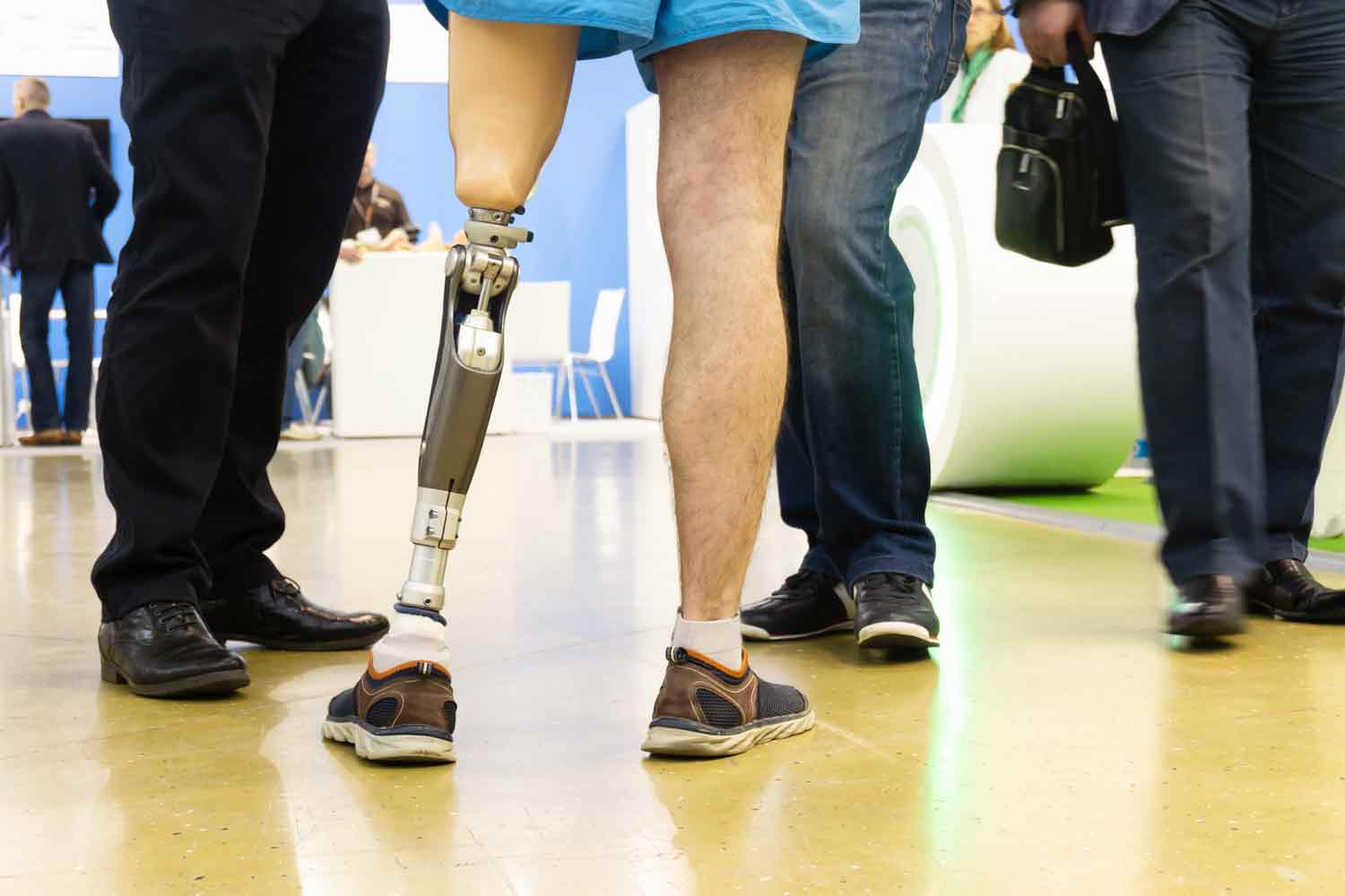 man in medical center learning to walk with prosthetic leg