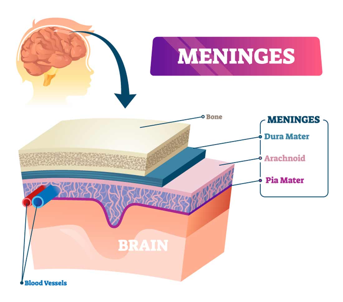 meningitis graphic illustration shows labeled anatomy of the head