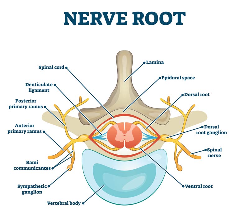 nerve root anatomical structure 