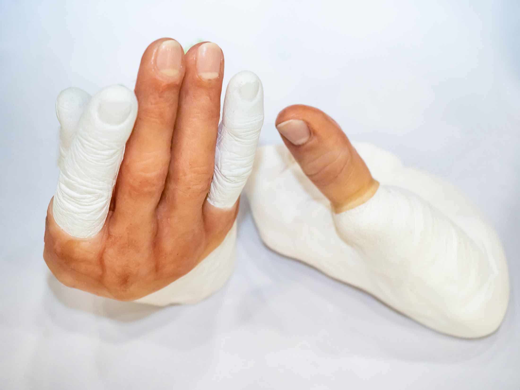 prosthetic fingers