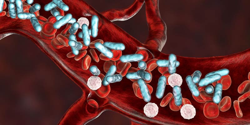 sepsis bacteria in blood