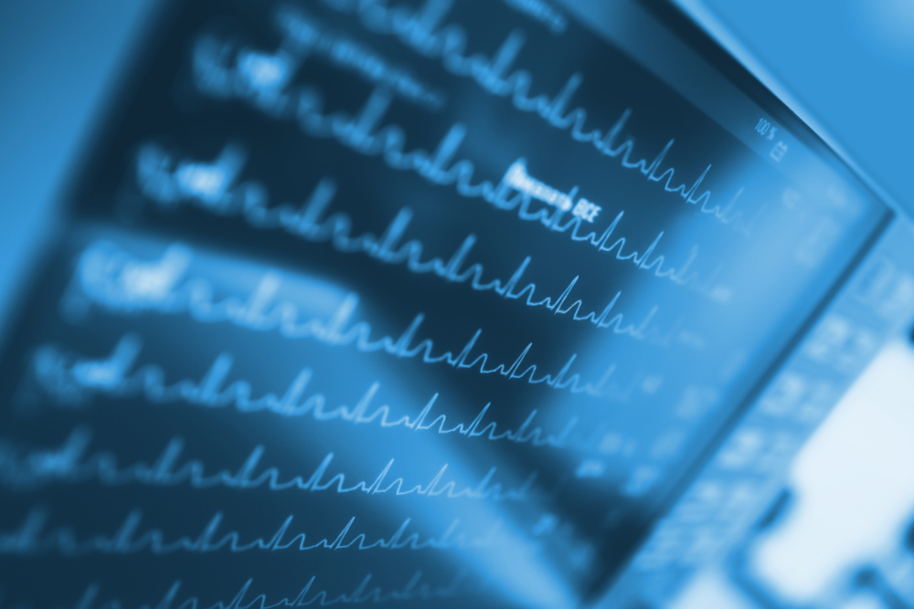 Close-up of a printed document with lines of text