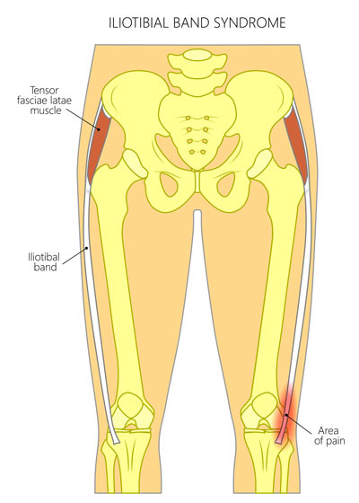 a front bony skeletal view of the pelvis and thighs