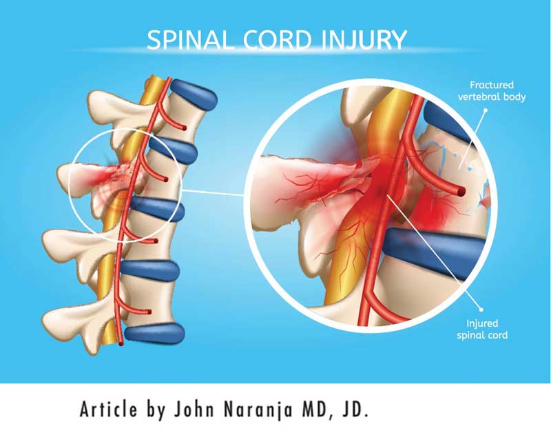 spinal cord injuries