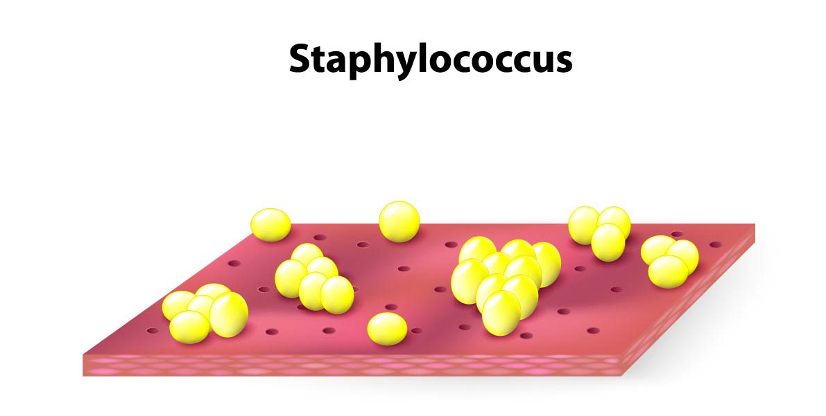 staphylococcus