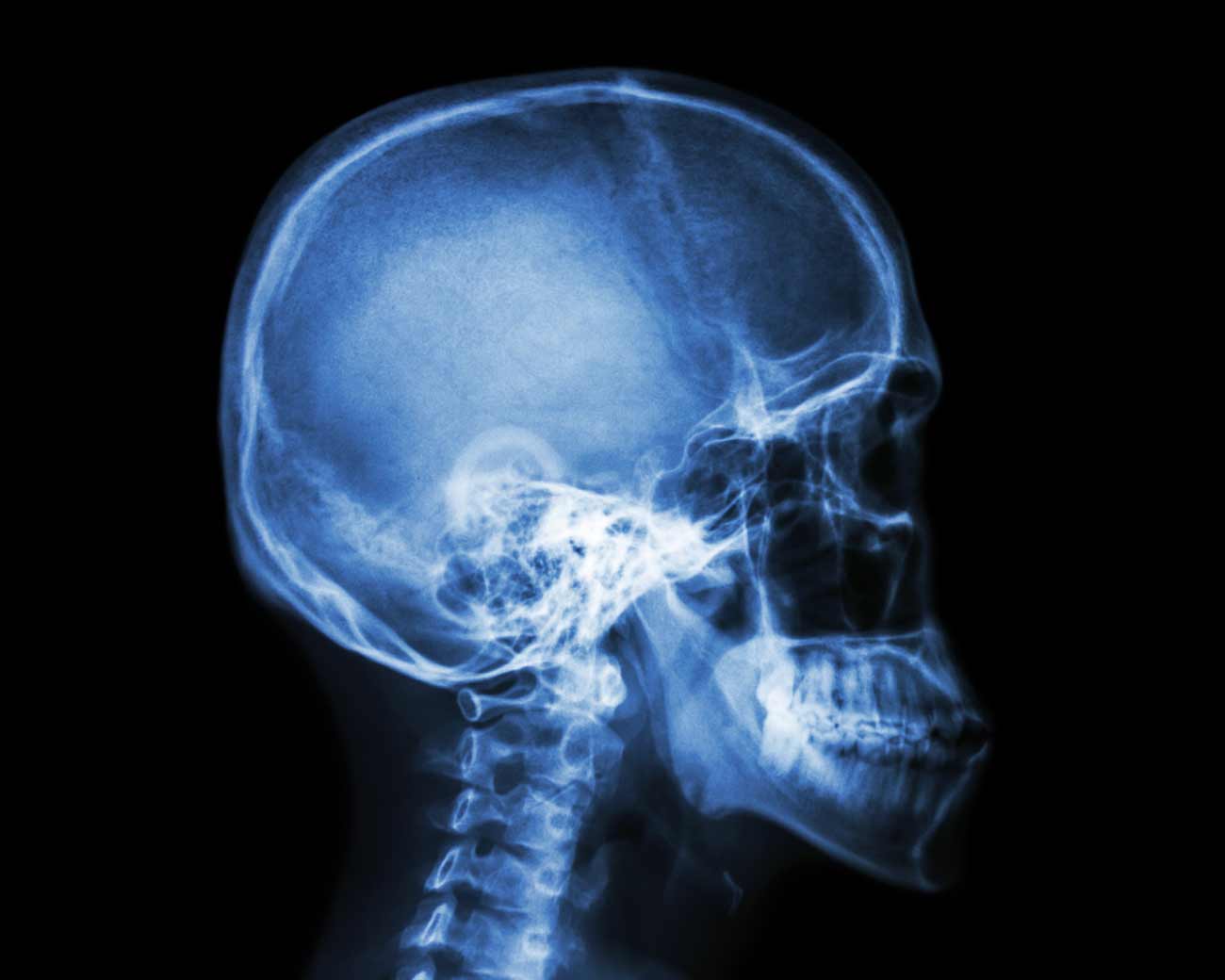 x-ray_skull and cervical spine lateral view